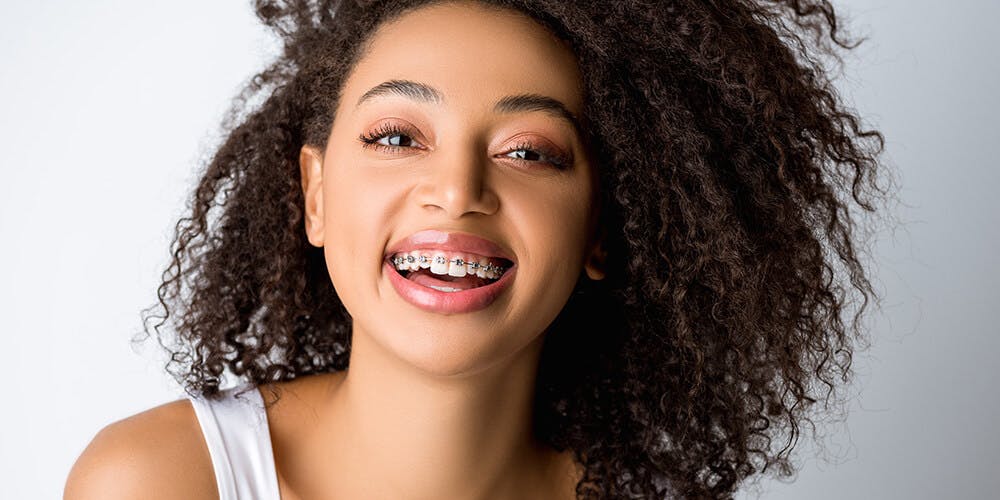 Dental Braces in Oakville Dental Braces in Oakville