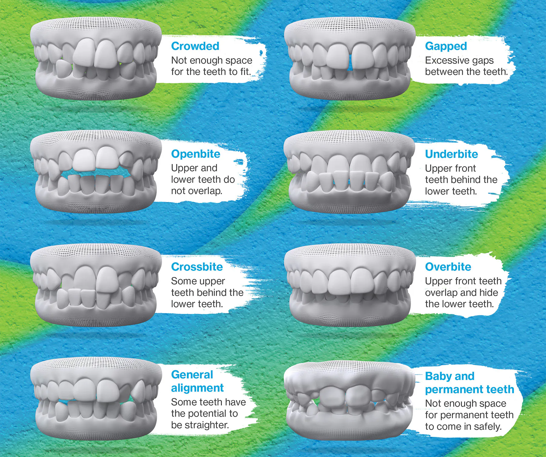 Orthodontics Landing Page - SmileVille Dentistry  - Dentist Oakville