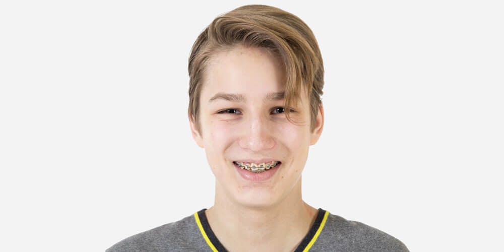 How Orthodontics Can Improve Your Overall Health How Orthodontics Can Improve Your Overall Health