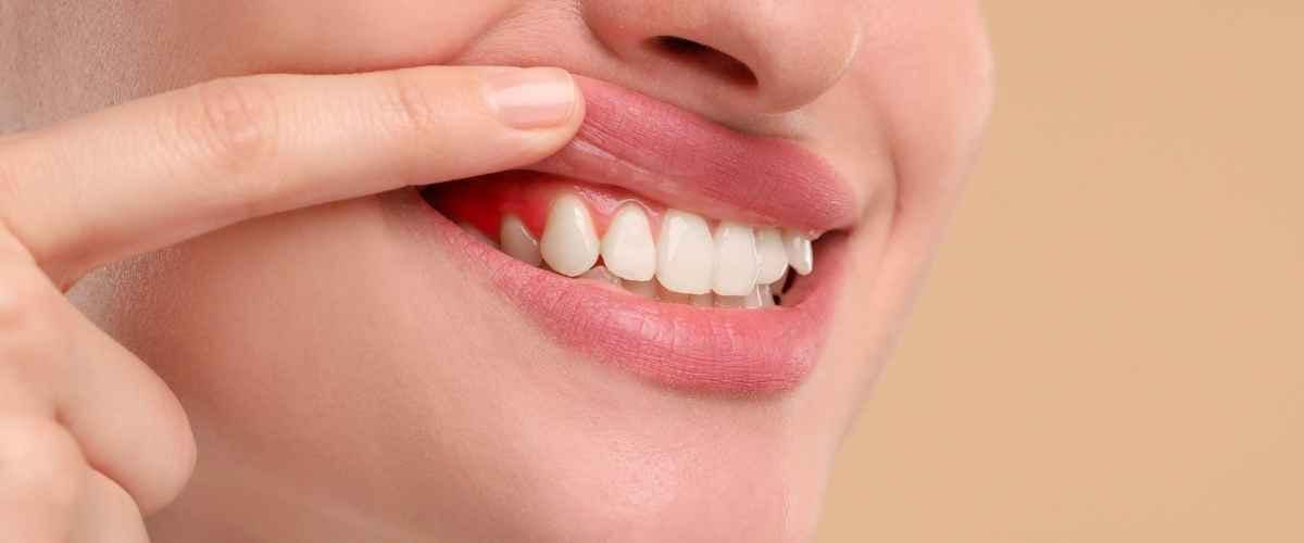Don't Ignore the Bleeding: Signs You Need a Deep Dental Cleaning Right Away